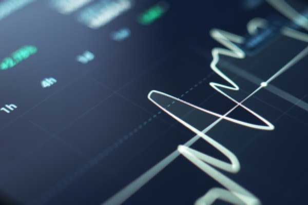 给外卖骑手交五险一金，不是唯一正确的解决方案(2025年03月01日)